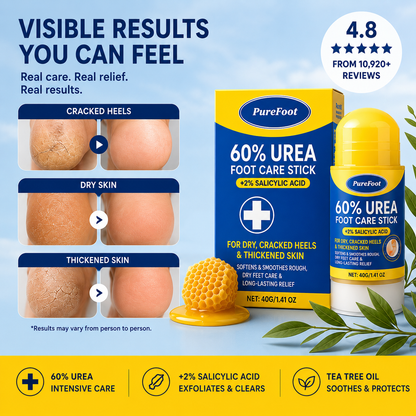 Nuvelle PureFoot Relief Stick™